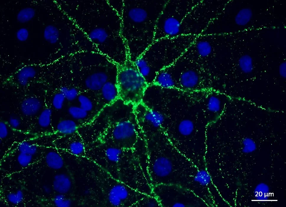 Nervenzellen unter dem Mikroskop. Grüne Punkte zwischen größeren blauen zeigen Synapsen.